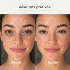 Stick 2-en-1 Blush + correcteur l Élu Meilleur Produit K-Beauty 2025