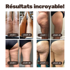Legging Sculptant 3D - Anti-Cellulite OlO