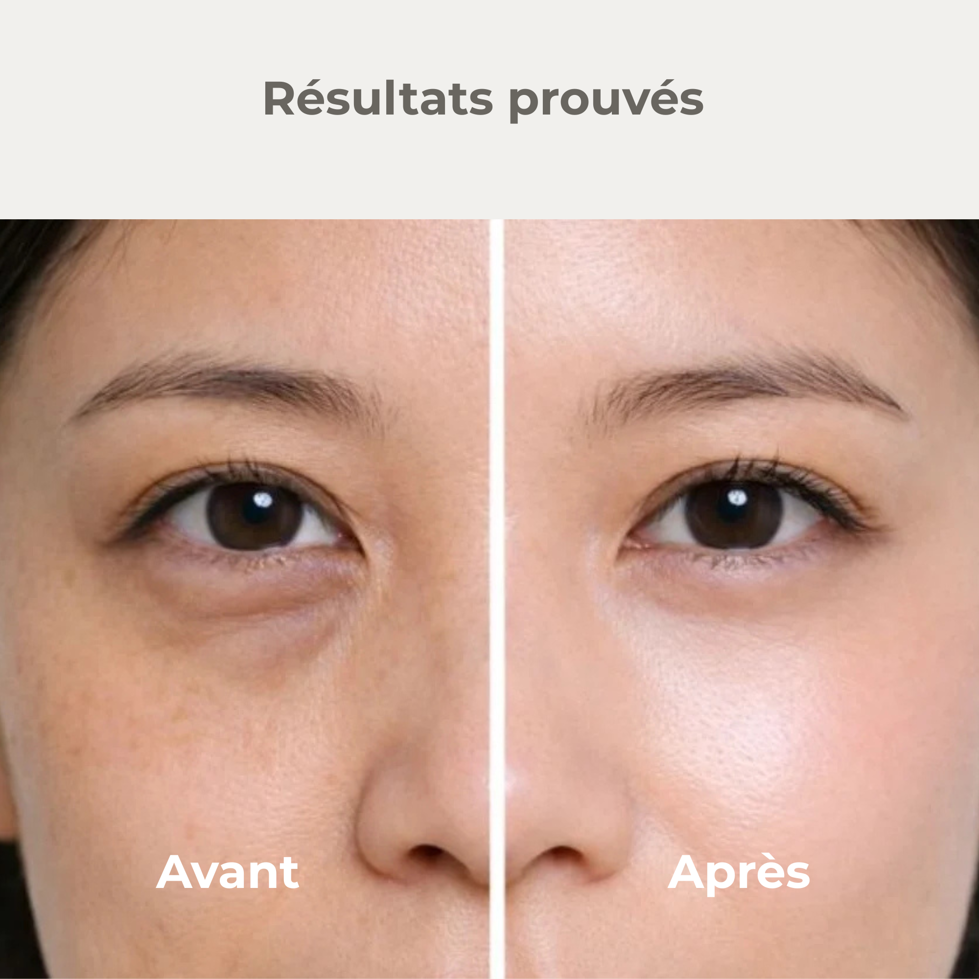 Stick 2-en-1 Blush + correcteur l Élu Meilleur Produit K-Beauty 2025